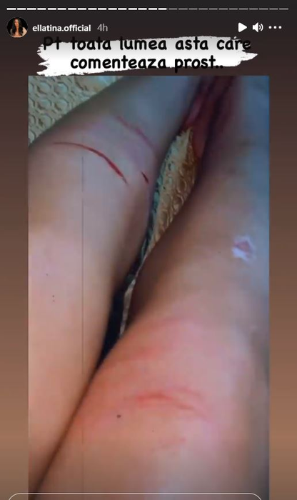 Ella de la Puterea Dragostei, declarații acide după ce a fost criticată la scurt timp după ce a fost implicată într-un grav accident: “Poate nu aveam o mână sau un picior” | FOTO