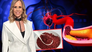 Alimentul consumat rar de români pe care Mihaela Bilic îl recomandă: „Ne ajută în lupta împotriva colesterolului”