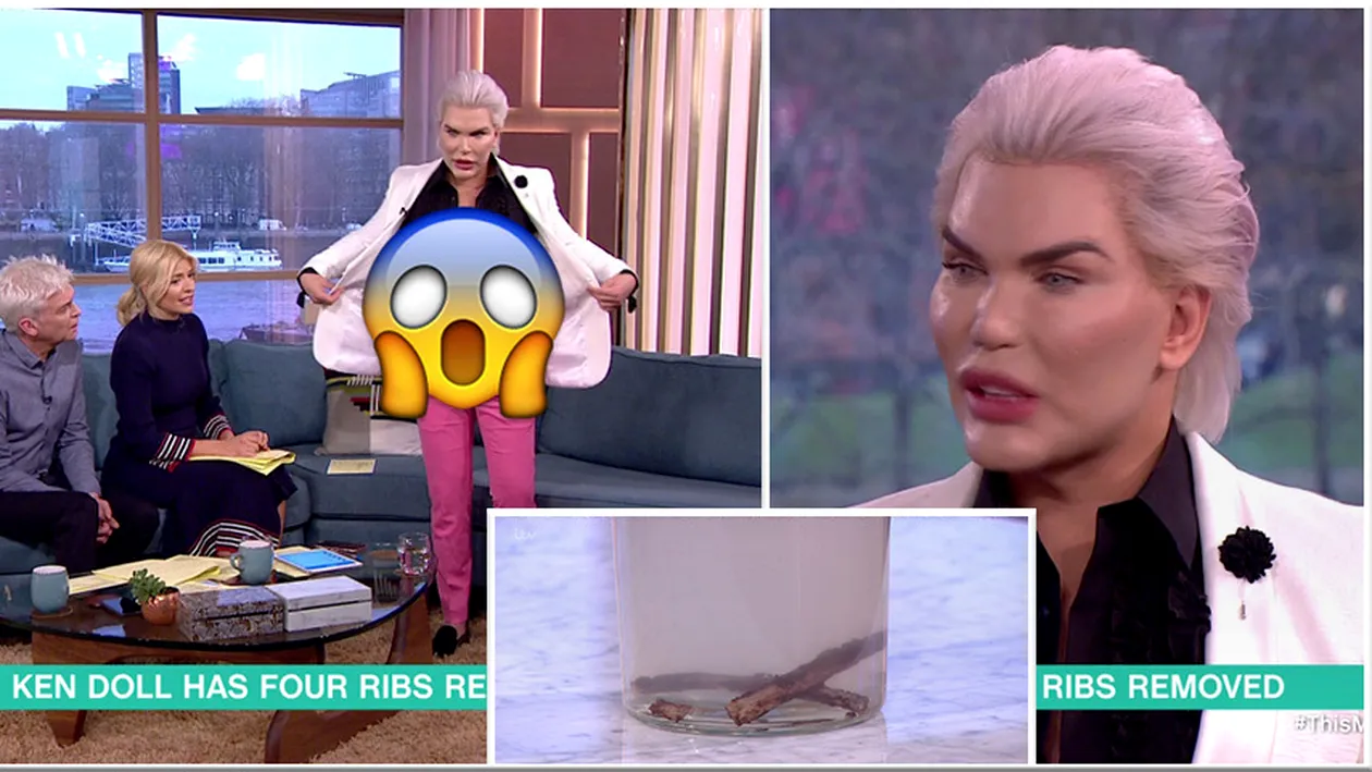 Rodrigo Alves si-a scos COASTELE! Cum arata acum Papusa Umana Ken si de ce a facut-o. Motivul este ireal de STUPID!!!