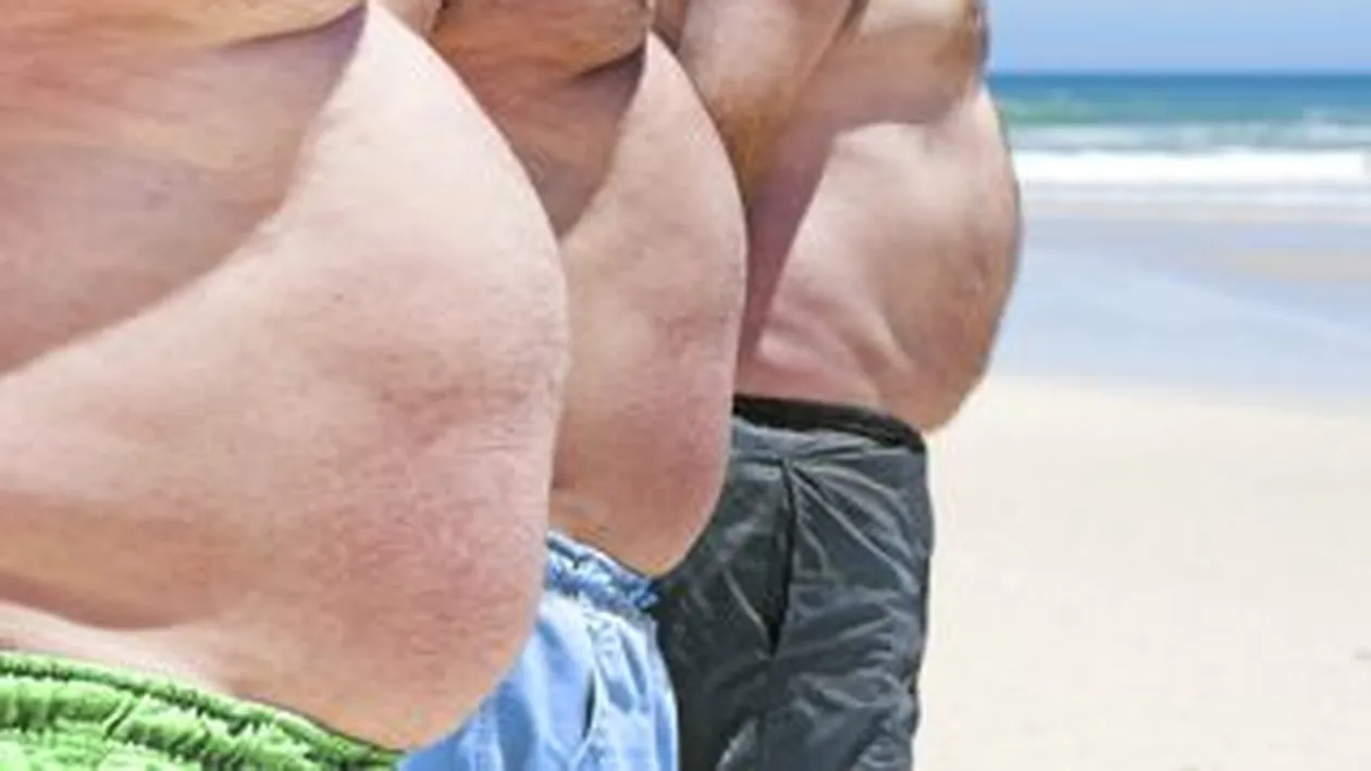 Potrivit unui studiu, obezitatea contribuie la aparitia dementei