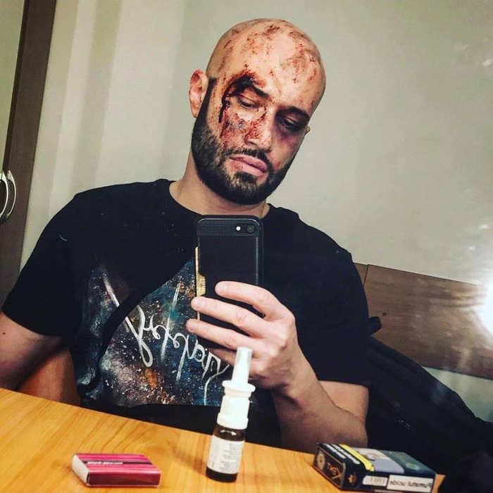 Bendeac a recunoscut că depresia l-a adus în pragul sinuciderii de trei ori