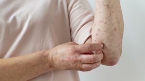 Alertă medicală în România! Medicii trag un semnal de alarmă după creșterea neașteptată a numărului de cazuri