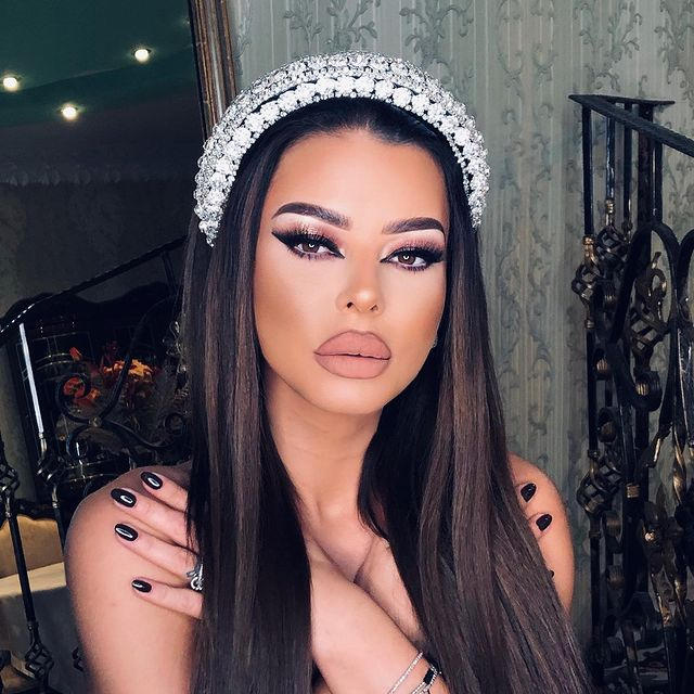 Ana Mocanu se confruntă cu o alergie cronică/ Sursă foto: Instagram.com