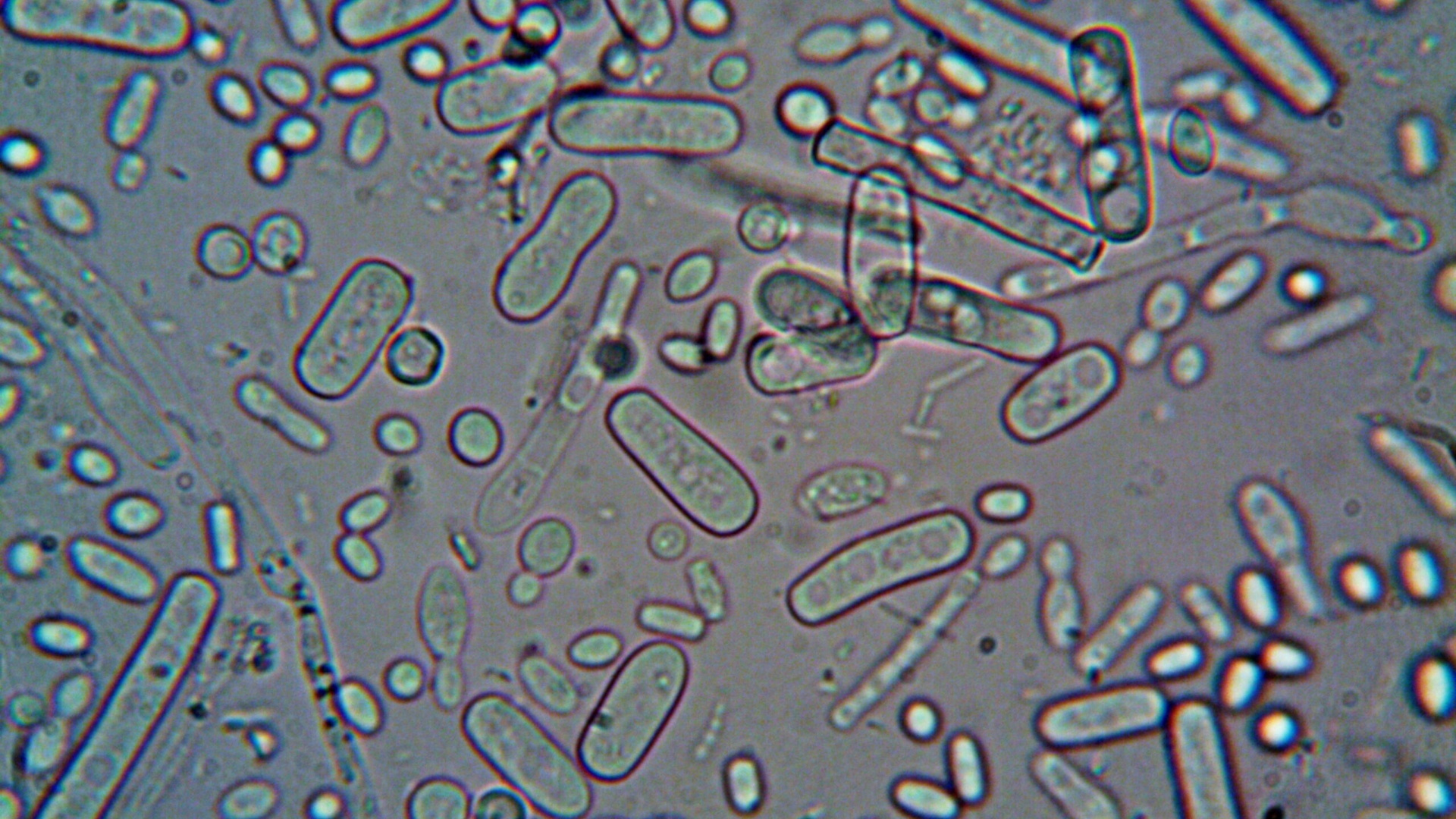 Bacteria care face tot mai multe victime în apele din America! Cinci oameni au murit deja