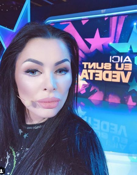 Brigitte Năstase şi-a operat din nou faţa! Primele imagini după intervenţia estetică