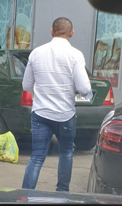 Lui Florin Pastramă i-a eşuat implantul de păr!