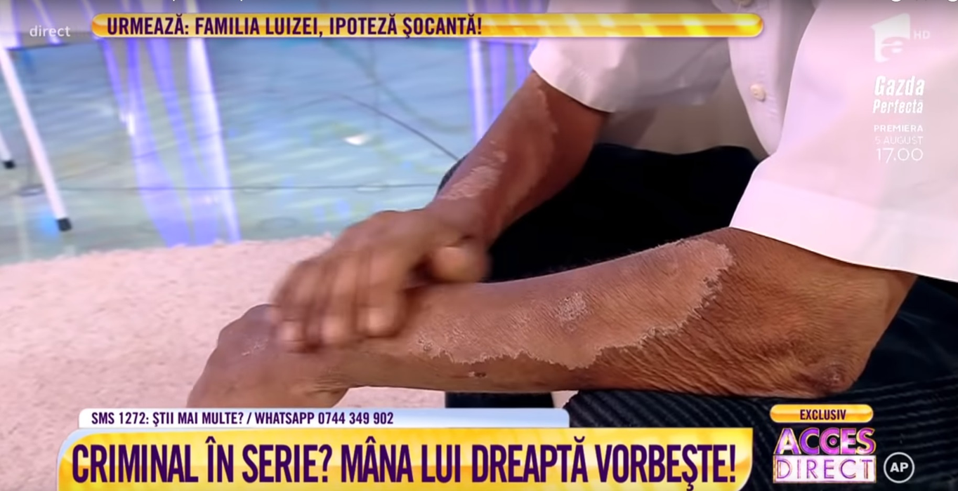 Luis Lazarus a răbufnit după ce a aflat că Ștefan Risipiceanu a violat-o pe Luiza Melencu: “Eu l-am descoperit pe bărbatul ars pe mâini, chiar din prima zi”