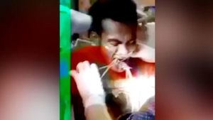 Priveşte cum medicii încearcă să-i scoată din gât un peşte viu! IMAGINI ŞOCANTE! 