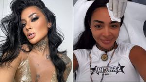 Naba Salem a mai bifat o intervenție estetică. Ispita de la Insula iubirii s-a lăudat pe internet