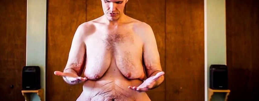 Caz cutremurător! La doar un an băiatul din imagine cântărea 23 de kilograme! E incredibil la ce greutate a ajuns la 15 ani