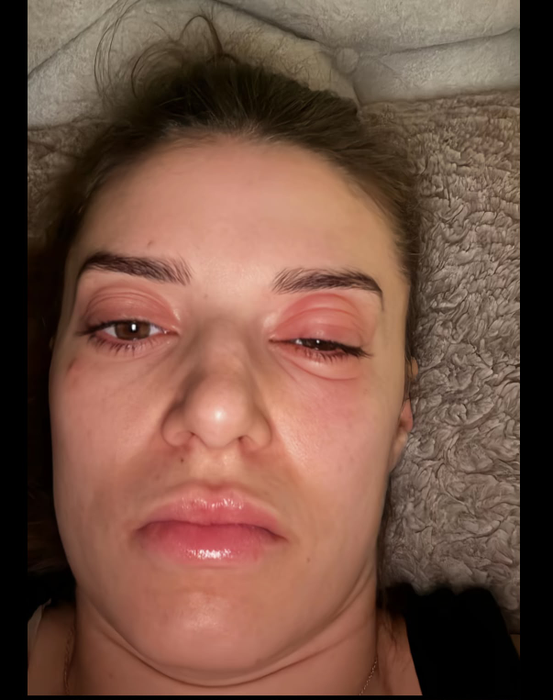 „Perla Banatului”, cu ochii umflați!