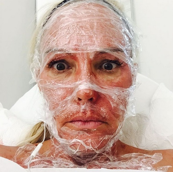 Natascha Ochsenknecht, tratament facial