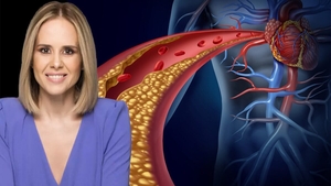 Alimentul care ne scapă de colesterol, potrivit medicului nutriționist Mihaela Bilic: "Dacă sunteți sedentari, ajută"