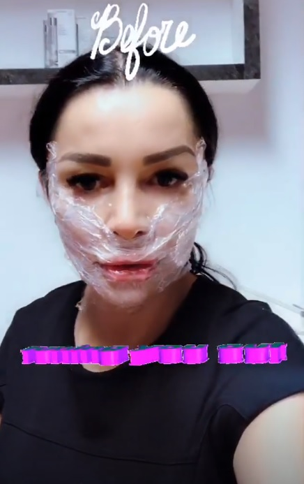 Brigitte Sfăt a ajuns, din nou, pe mâna medicilor esteticieni. Ce și-a făcut vedeta