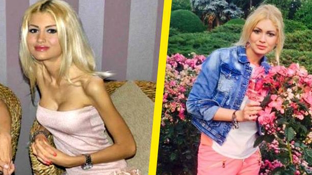 Anorexica Flavia Apostol s-a îgrăşat! În 2013 tânăra cântărea doar 35 de kilograme!