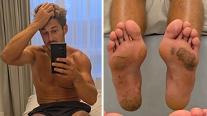 Cum arată tălpile concurenților de la Survivor, după ce au stat desculți 4 luni în jungla dominicană. Întors în România, Alberto Hangan a făcut publice imaginile