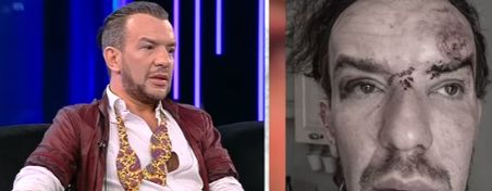 Stephan Pelger, prima apriție după ce a fost bătut la Cannes: „Mi-au pus ceva în băutură, s-a găsit şi în sânge!”