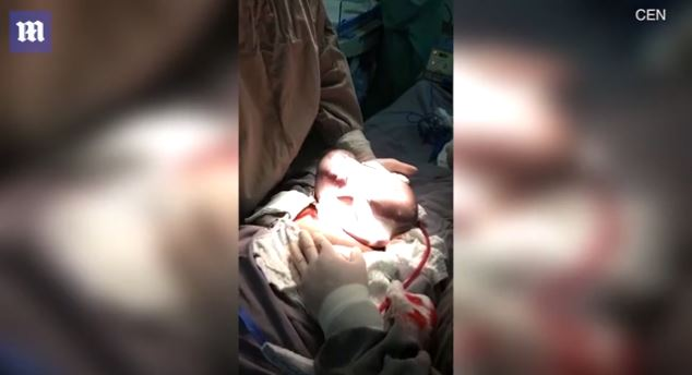 Imagini emoționante în sala de operații: un băiețel s-a născut în timp ce era încă în sacul amniotic. Cazul este foarte rar: 1 la 80.000 de nașteri | FOTO & VIDEO