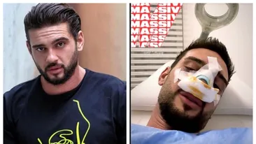 A zis că nu-și va opera nasul niciodată, dar s-a răzgândit! Cum arată Dorian „Hâtz” Popa, după ce și-a făcut rinoplastie