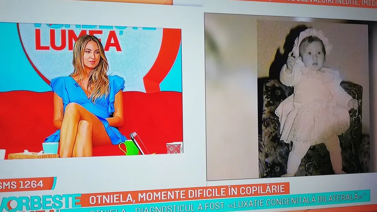 Otniela, dezvăluiri tulburătoare: ”Am avut un picior mai scurt!” Când a făcut primii pași