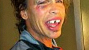 Steven Tyler, solistul trupei Aerosmith, a cazut in baie si si-a rupt doi dinti! Uite-l cum arata desfigurat!