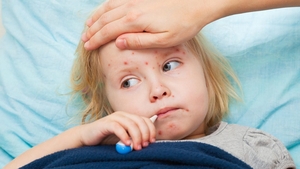 Epidemia de rujeolă, uitată de autorități! Numărul de cazuri a trecut de 20.000 în aprilie. Marea majoritate sunt copii