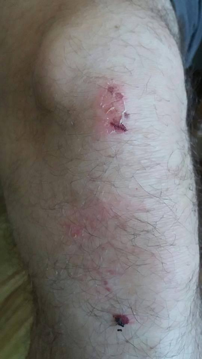 Polițistul a fost mușcat în misiune