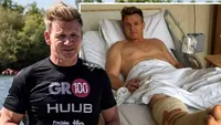 Chef-ul Gordon Ramsay, cu piciorul în ghips după un accident. Imagini de pe patul de spital!