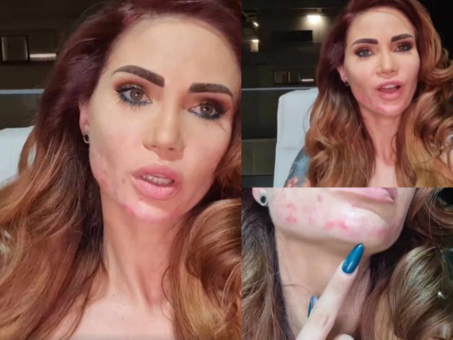 Maria Ilioiu a rămas mutilată după o intervenție estetică