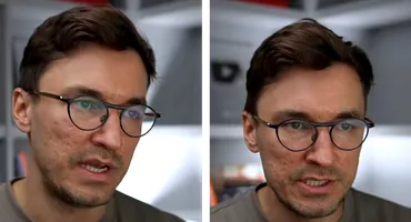 Ce trebuie să faci pentru a preveni un accident vascular, potrivit medicului Mihail Pautov: ”Real!”