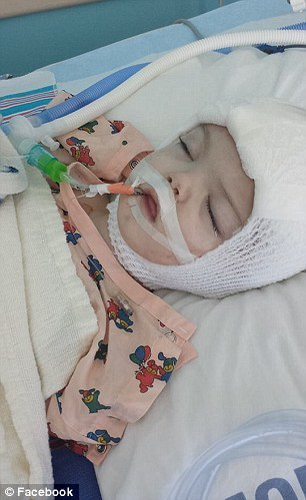 Emoţionant! Doi gemeni se privesc în ochi, după ce s-au născut lipiţi în zona capului