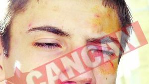 Elev ungur batut de extremistii romani