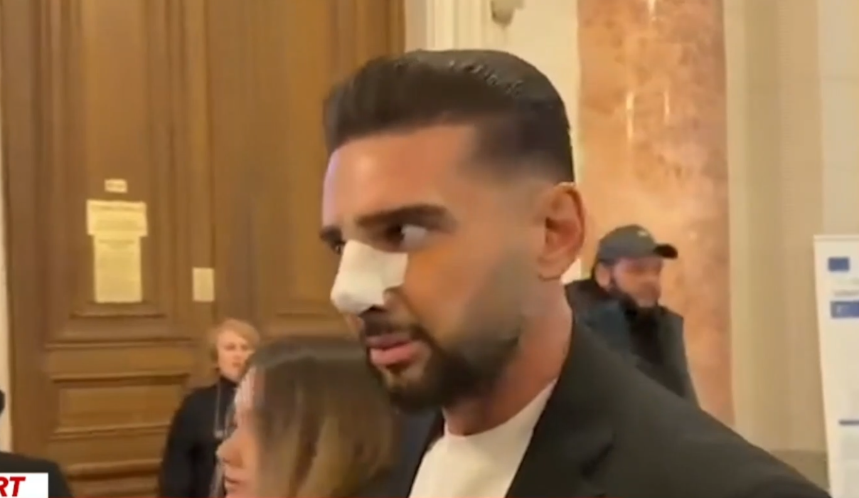 Dorian Popa și-a dat bandajele de la nas jos: „Am plâns ca un bebeluș.” Care este motivul?