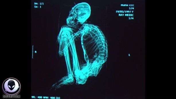 Au găsit mai multe cadavre ciudate şi au cerut părerea experţilor. S-au făcut câteva teste, iar rezultatele au fost şocante. Ce descoperiseră de fapt