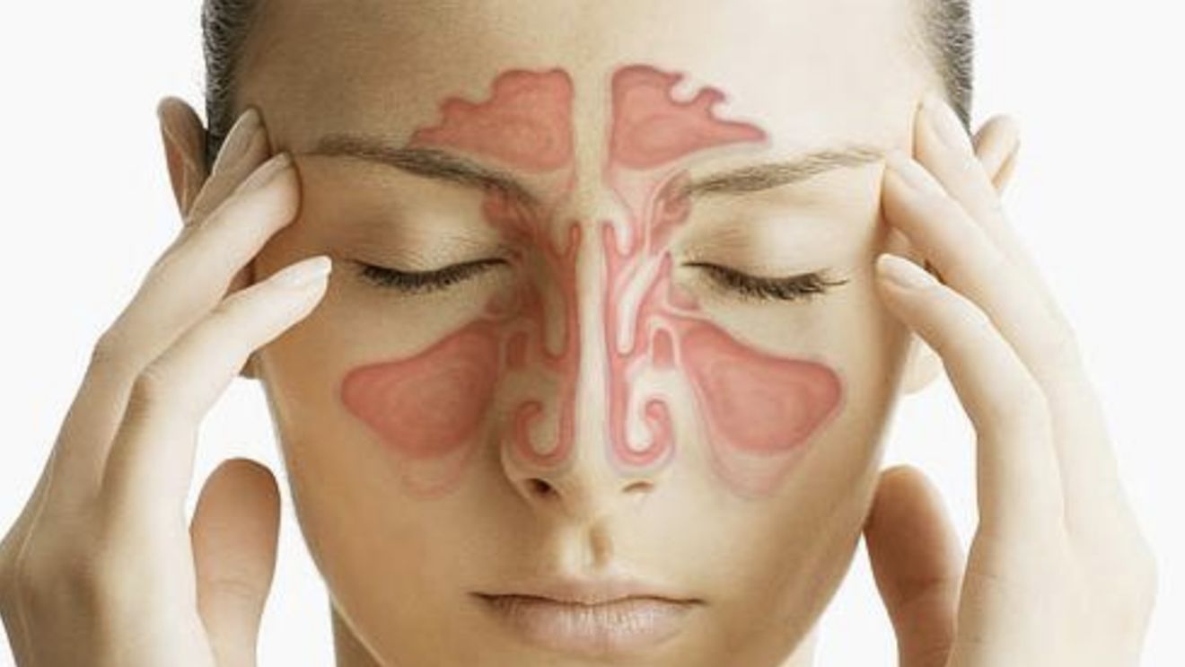 Durerea de cap - cauze și remedii în funcție de zona dureroasă