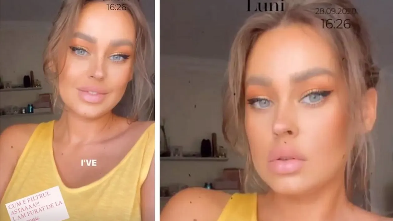 Misha, pe mâinile medicilor esteticieni. Artista a dezvăluit ce schimbare importantă își face: “Abia aștept să văd rezultatele”