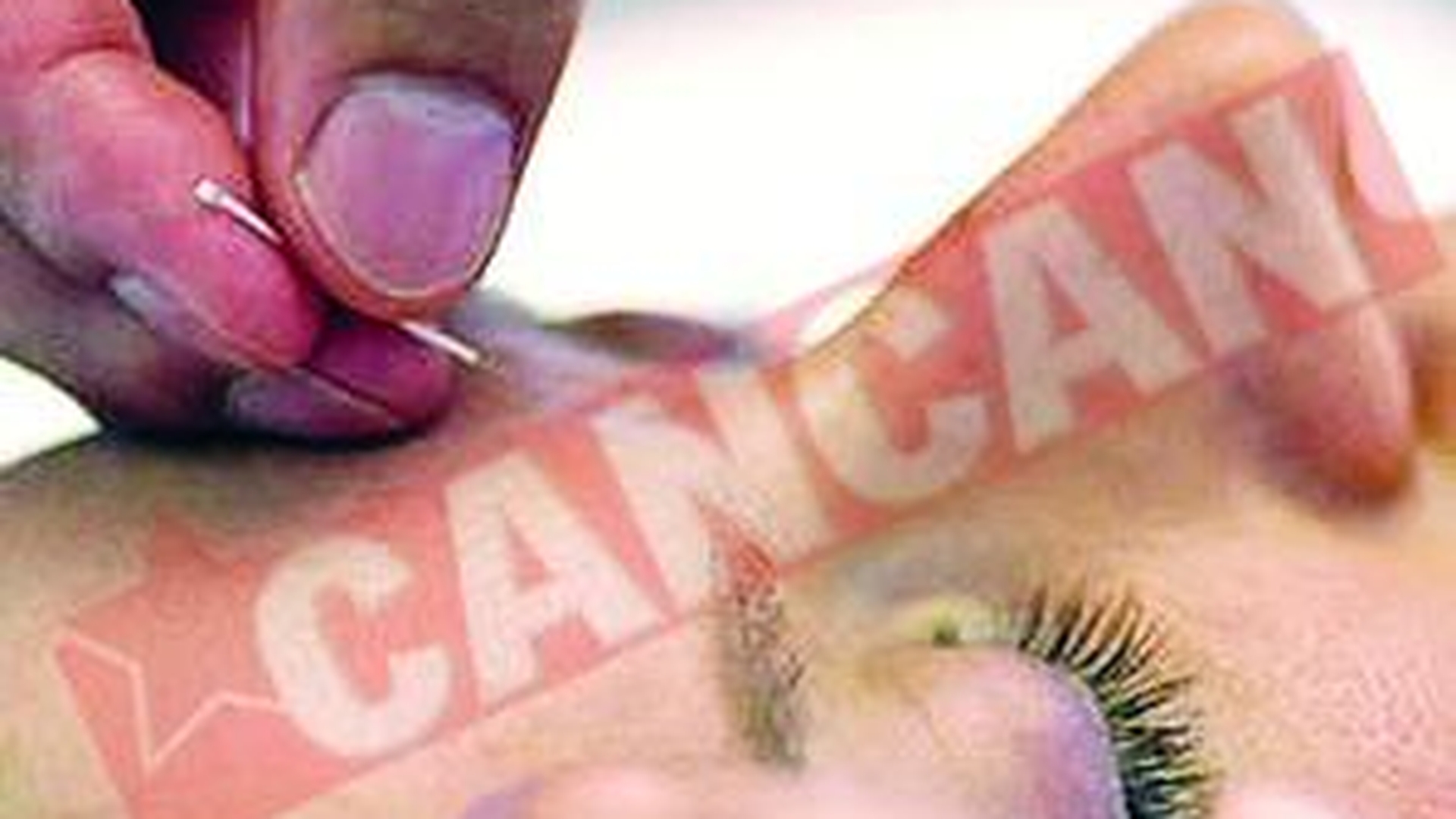 Acupunctura are aceleasi efecte ca si calmantele