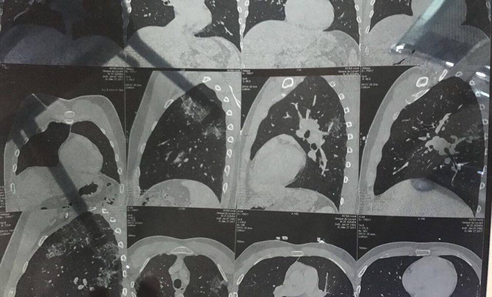 Radiografiile lui Peter Kai