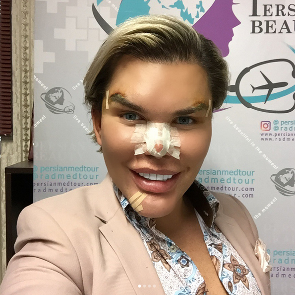 „Păpuşa umană Ken” s-a operat din nou! Cum arată Rodrigo Alves acum, după intervenţia făcută pentru a semăna cu o pisică!