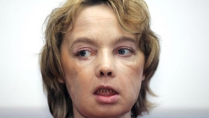 Medicii i-au dat o faţă nouă, dar nu au mai putut să o salveze! A murit prima femeie supusă unui transplant de faţă!