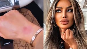 Adevărul din spatele vânătăilor pe care le are Bianca Drăgușanu. Cu cine s-a bătut blondina, de fapt