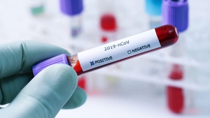 Cum afli dacă ai coronavirus. Cum arată și cum se face testul Covid-19