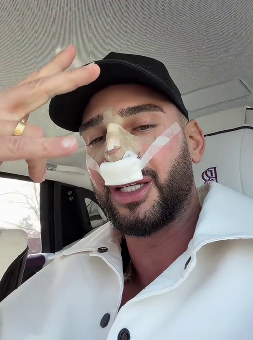 Dorian Popa, la un pas să îi „cadă nasul ca lui Michael Jackson”! Ce i-a descoperit medicul la operație? „Habar nu aveam”