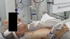 Un pacient infectat cu coronavirus a fost internat trei zile la o secţie de terapie intensivă non-COVID din Spitalul Județean Craiova. Acum se caută vinovații
