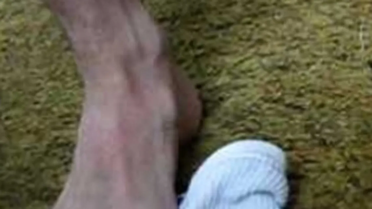 Cum poti combate malaria? Cu sosete murdare!