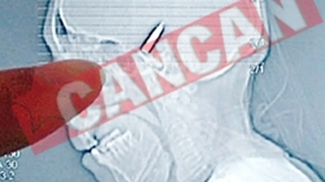 A trait 64 de ani cu un glonte in cap