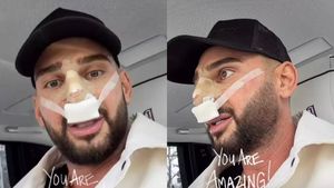 Cum arată nasul lui Dorian Popa, la 12 zile de la intervenție. Artistul a publicat prima imagine