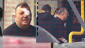 Primele & singurele imagini cu faimosul Beinur după ce a fost împușcat!