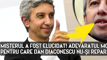 Mister ELUCIDAT: De ce nu-şi repara Dan Diaconescu dinţii