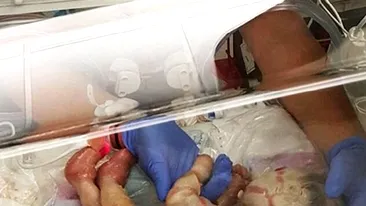 O fetiță i-a șocat pe părinți și medici la naștere. “Arăta ca un extraterestru!” Cum arată acum, la aproape un an distanță
